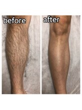 パーソナルエステティックサロン リボーン(ReBorn)/