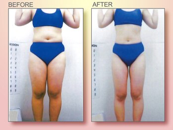 ジュリア オージェ 京橋店/ビフォーアフター(ターゲット)