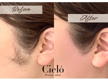 シエロ 川崎店(Cielo)/『もみあげ脱毛』