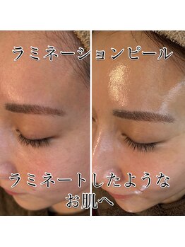 ゆでたまご/次世代ピーリング