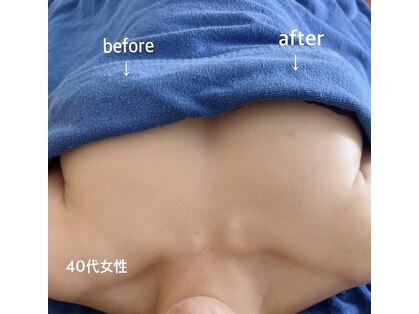 アナパナパ(anapanapa)の写真