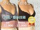 シャンス アルファ(chance)の写真