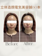 サロン ド ハリッシュ(Salon de HARISH)/むくみの改善