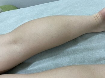 ナノハナ/鹿沼市全身脱毛美容室ナノハナ