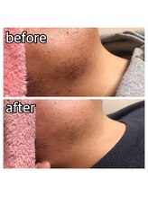 パーソナルエステティックサロン リボーン(ReBorn)/