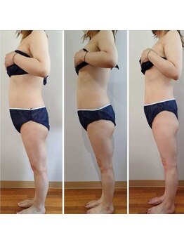 ワンルーム(1ROOM)/2ヶ月のBefore　After