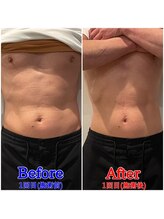 ファビー(Fabby)/マグフォース1回のビフォアフ