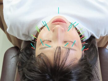 しのとう鍼灸整体院/美容鍼
