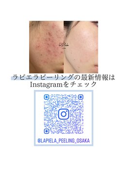 ラプア(Lapua)/フォローお願いします