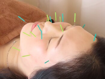 はやかわ鍼灸整骨院/おてがる美容鍼 回数券☆