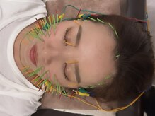 ソラナ(Solana)/美容鍼【100本】百華鍼