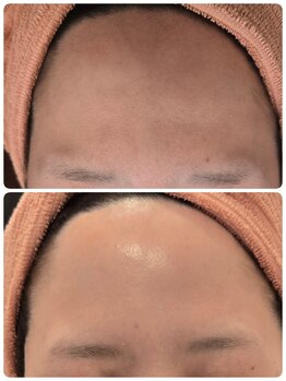 サロンド シェリー(Salon de Cherie)/韓国肌♪つるんとしたお肌へ