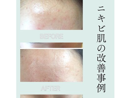 石井クリニック美容研究所エステティク 熊本サロンの写真