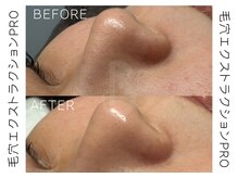 ベル(BELLE)の雰囲気（札幌/大通/すすきの/豊水すすきの/フェイシャル/毛穴/小顔/美白）