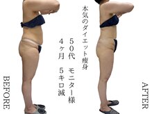 制限なしで綺麗に痩せる痩身温活エステでー５kg/成田