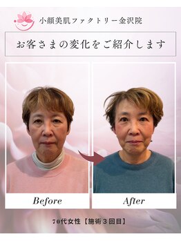小顔美肌ファクトリー 金沢院の写真/頑張る自分にご褒美を◇美肌×小顔×首肩マッサージ付フェイシャル