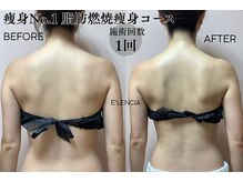 エレンシア(E'lencia)の雰囲気（１回で変化実感！【本気の痩身】機械×ハンドで脂肪にアプローチ）