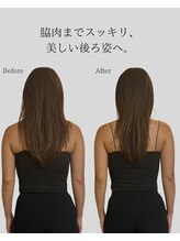 リ バース 立川(RE:birth)/美背中　BeforeAfter