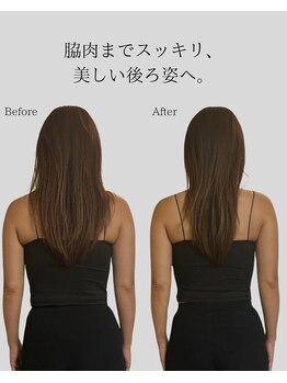リ バース 立川(RE:birth)/美背中　BeforeAfter