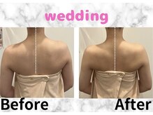 ミエル(Miel)/Before After