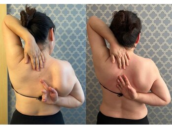 マイティー整骨院 ココア(CoCoa)/肩甲骨洗浄