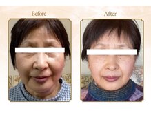 ハンズ鍼灸接骨院小牧院 美容整体ハンズ(美容整体hands)/エステ before after