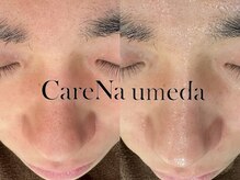 ケアナ 梅田店(CareNa)/メンズの清潔感ここにあり