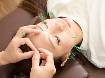 オン鍼灸整体院(ON鍼灸整体院)/美容鍼でむくみスッキリ