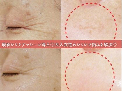 ドール(doll)の写真