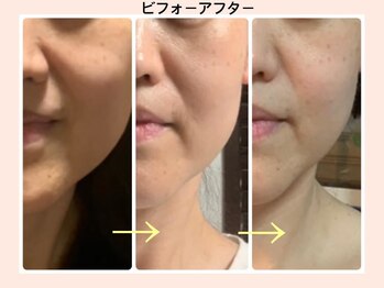 リファイン(REFINE)/小顔実感！お手入れが楽しくなる