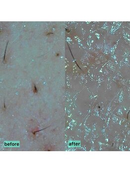 オーク(o.a.k)/お肌チェック