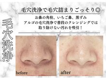 アルゴ 柳川店(ALGO)/大人気♪毛穴ごっそり大洗浄！