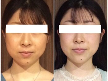 美容整体 ウェリナ 蟹江院/小顔矯正/骨盤矯正/美脚サロン