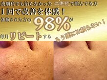 エステの効果をより持続させたいお客様は自宅ケアからお見直しを