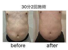 リブラ(LIBRA)/2回目でこの結果！！