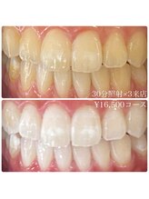 ホワイトニングルーム 横浜店(Whitening Room)/セルフホワイトニング/横浜