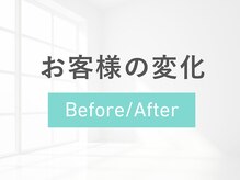 ルナティアラ(LUNAティアラ)/ニキビや毛穴でお悩み