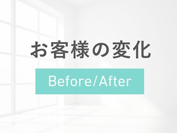 ルナティアラ(LUNAティアラ)/ニキビや毛穴でお悩み