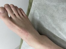 ナノハナ/鹿沼市全身脱毛美容室ナノハナ