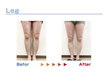 キングスサロン 熊本/足脱毛