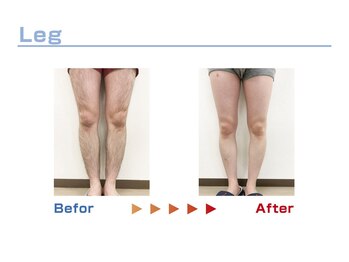 キングスサロン 熊本/足脱毛