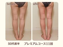 ヨサパーク ハーブ イムア(YOSA PARK imua)/◎お客様の変化