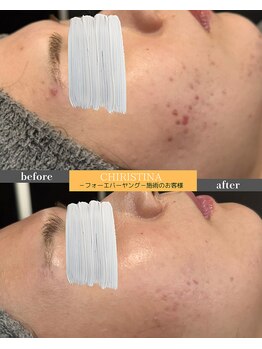 ケア(CARE)/クリスティーナ