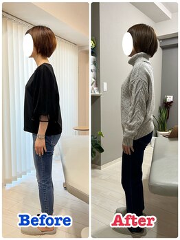 イデアル(iDeal)/前傾姿勢改善！博多・福岡・整体