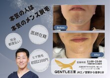 ジェントル 三宮