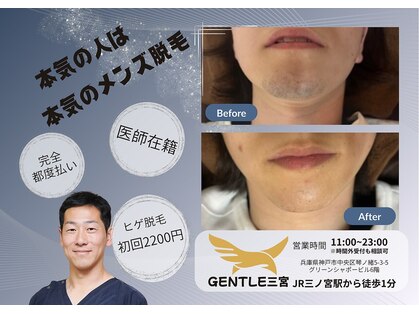ジェントル 三宮の写真