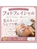 光エステ(コラーゲンパック付)¥17600→¥5500