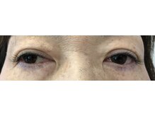 シルフ 松原店(Sylph)/Eye Beauty Salon Sylph 松原店