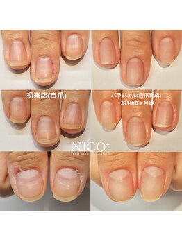 ニコプラス(NICO+)/