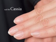 ネイル ライフ カッシア(nail life Cassia)の雰囲気（深爪・巻き爪など爪のお悩みご相談ください☆ケアメニュー多数！）